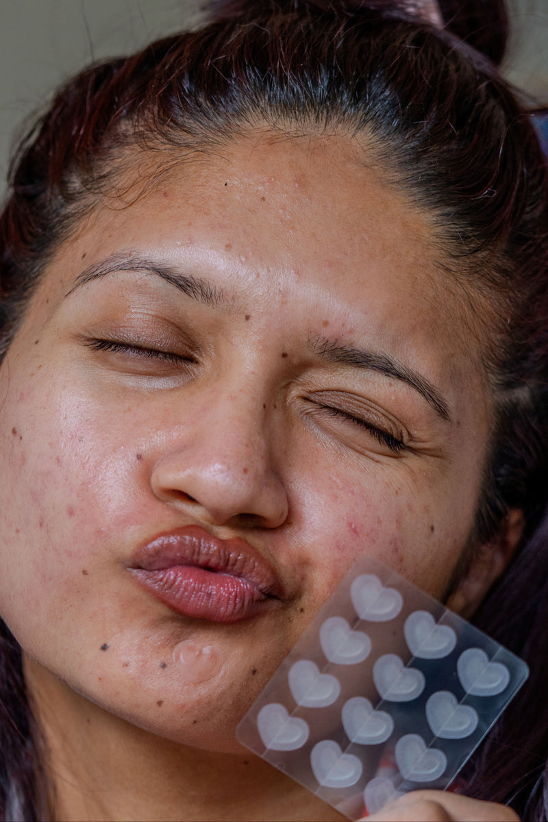 The Standard — The Patchly