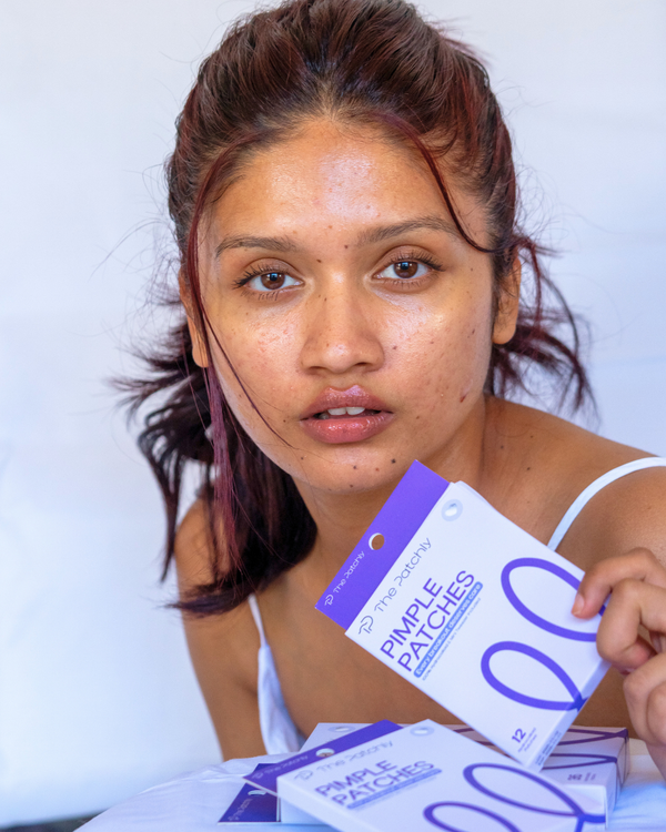 Patchly Hydrocolloid Pimple Patches – 12 Pack