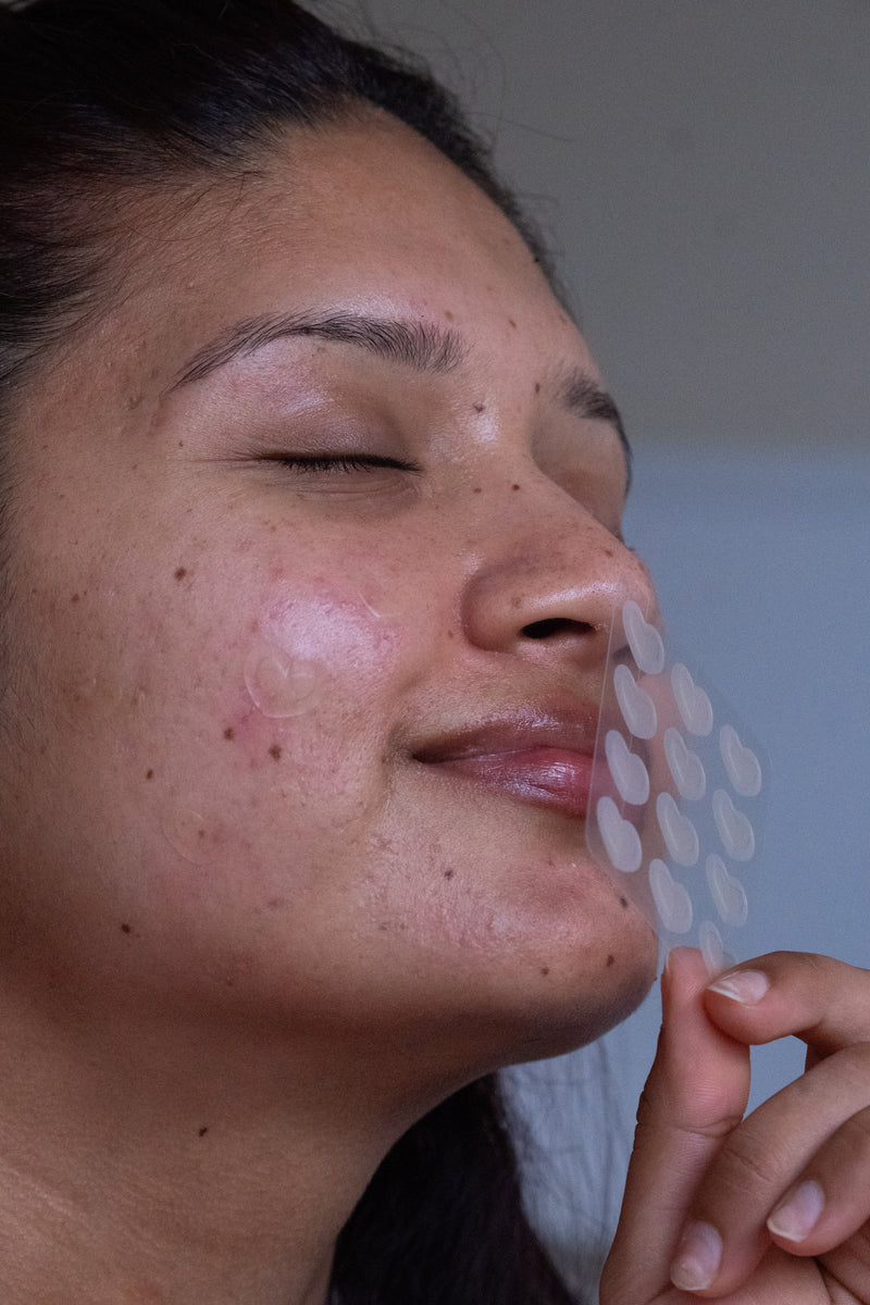 The Philosophy — The Patchly